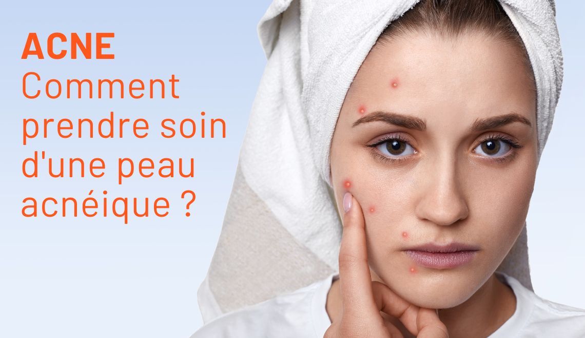 Comment prendre soin d'une peau acnéique ?