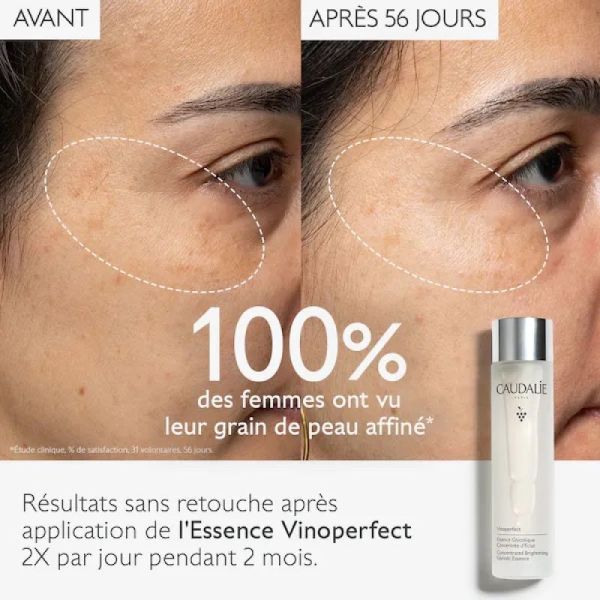 Caudalie Vinoperfect Essence Glycolique Concentrée d'Éclat 150ml